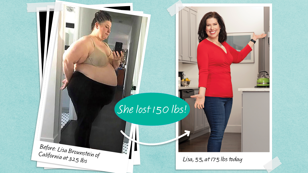 How Women Lost 150 lbs With No Loose Skin
