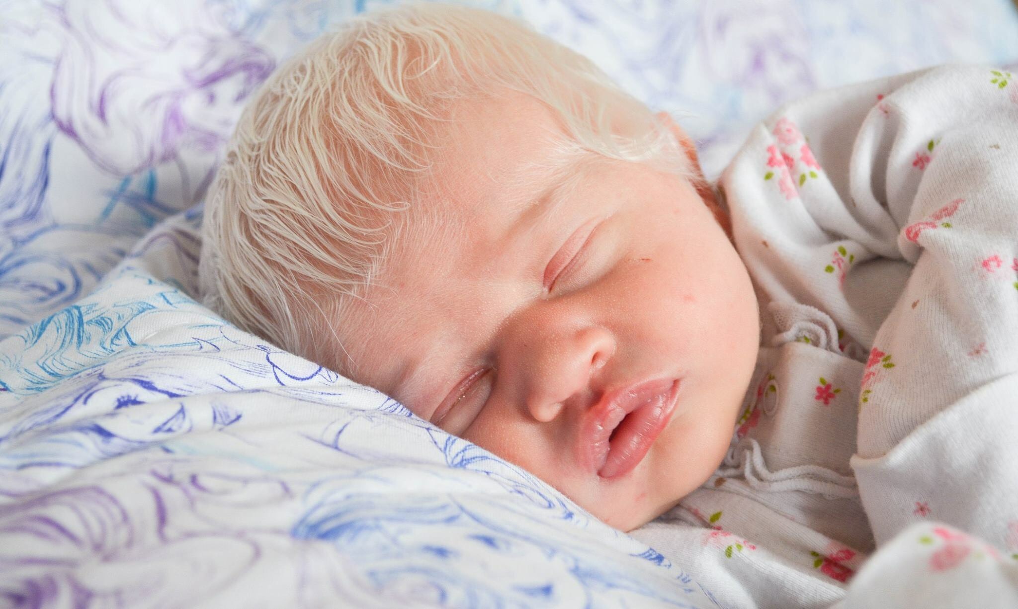 White Hair On Baby This Baby Was Born With The Same White Hair Streak As Her Mom Allure Nppa