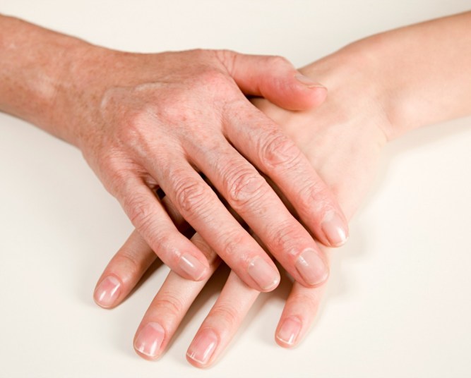 Age Spots On Hands Here S How To Get Rid Of Them