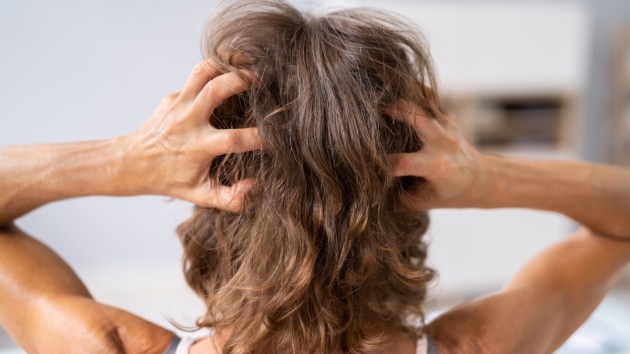 A woman with her fingers in her hair while checking for skin cancer on her scalp