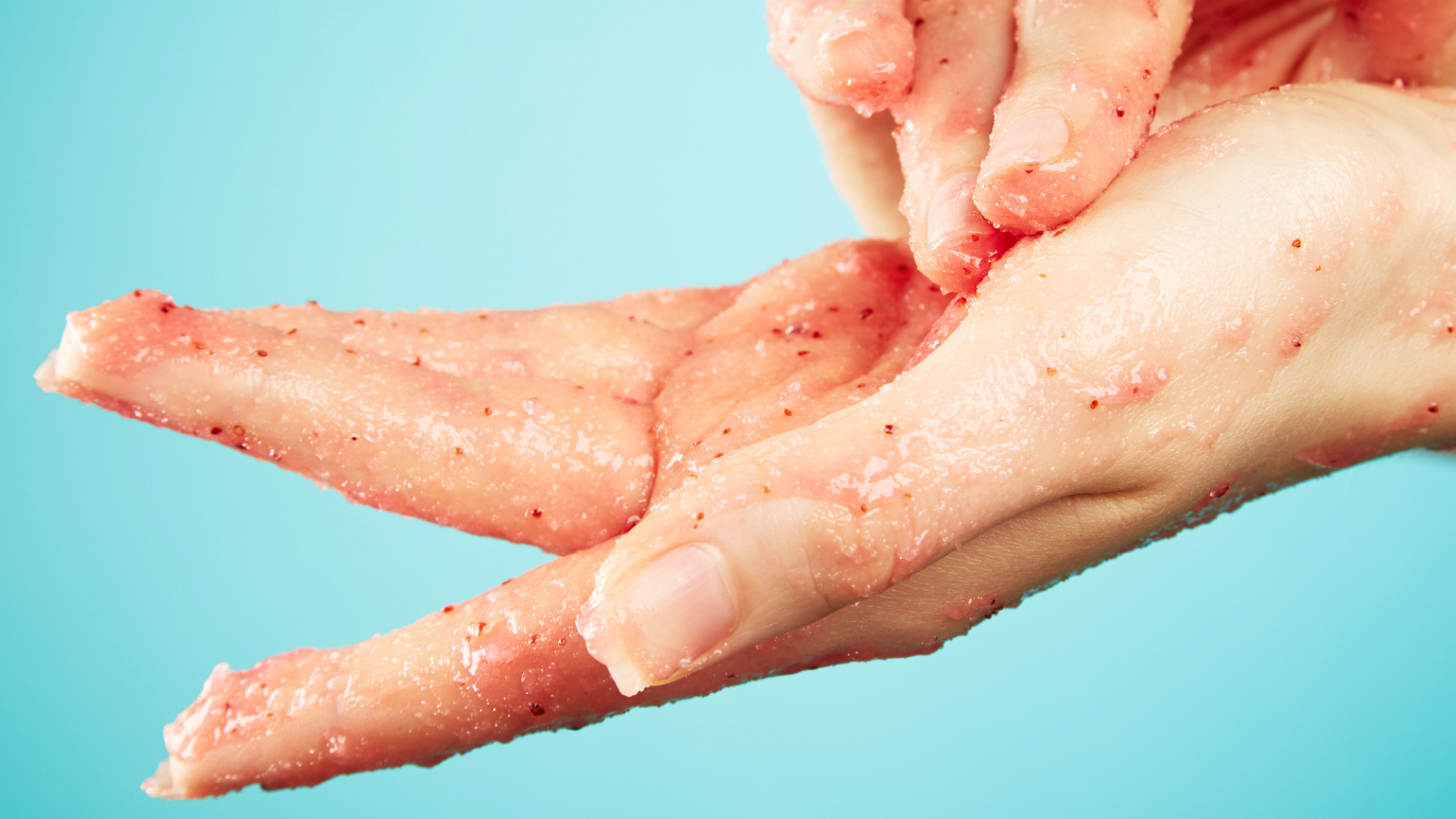 The Miracle Scrub That Naturally Cures Eczema Woman's World