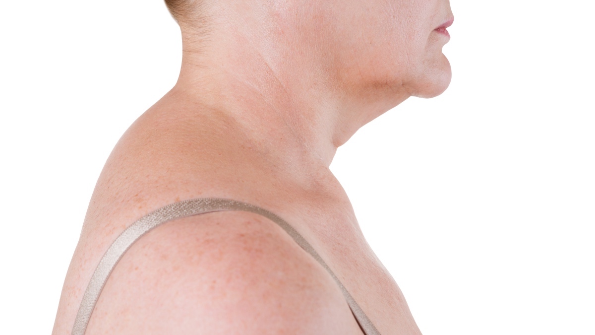How to Restore Natural Curve in the Neck with 6 Steps