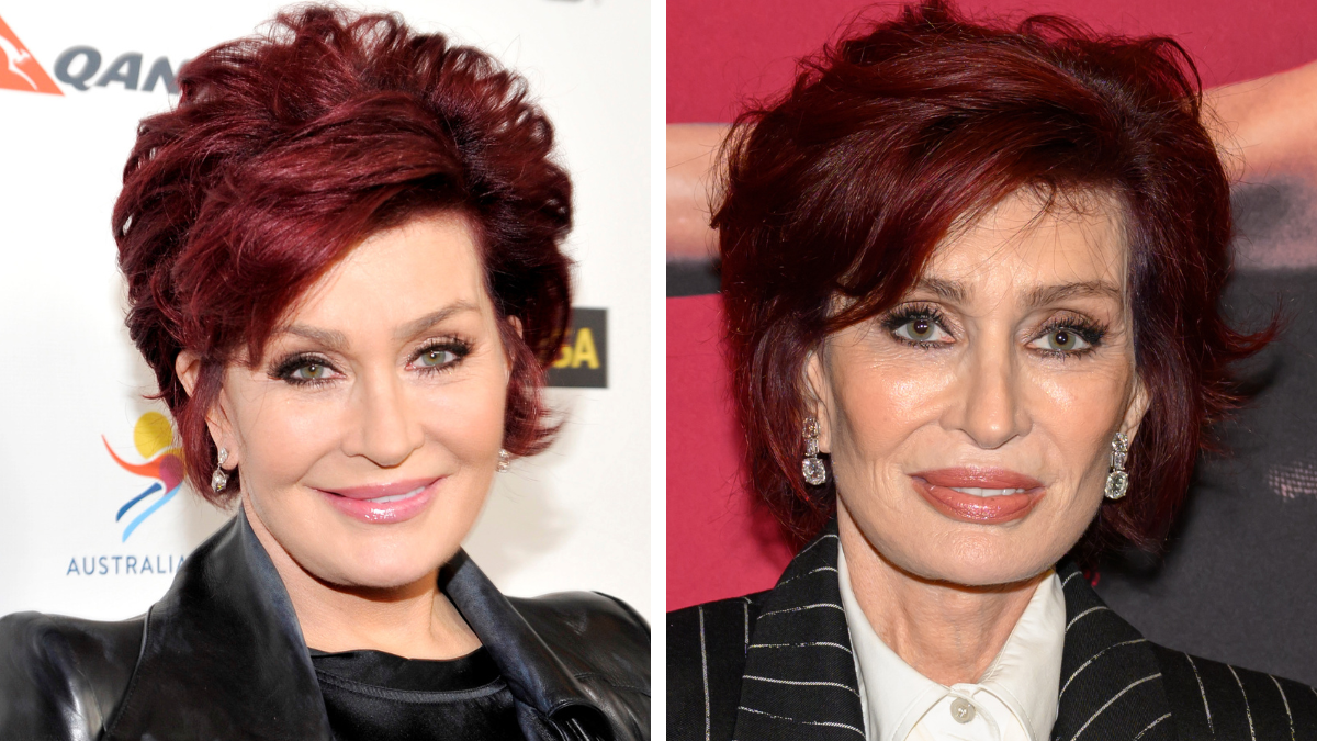 sharon osbourne before and after weight loss