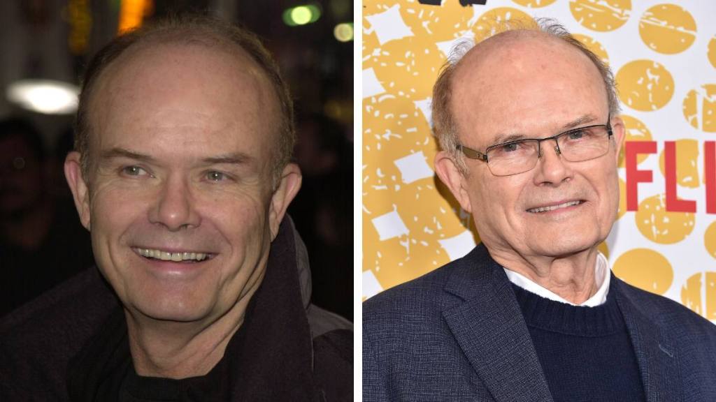 Kurtwood Smith; that '70s show