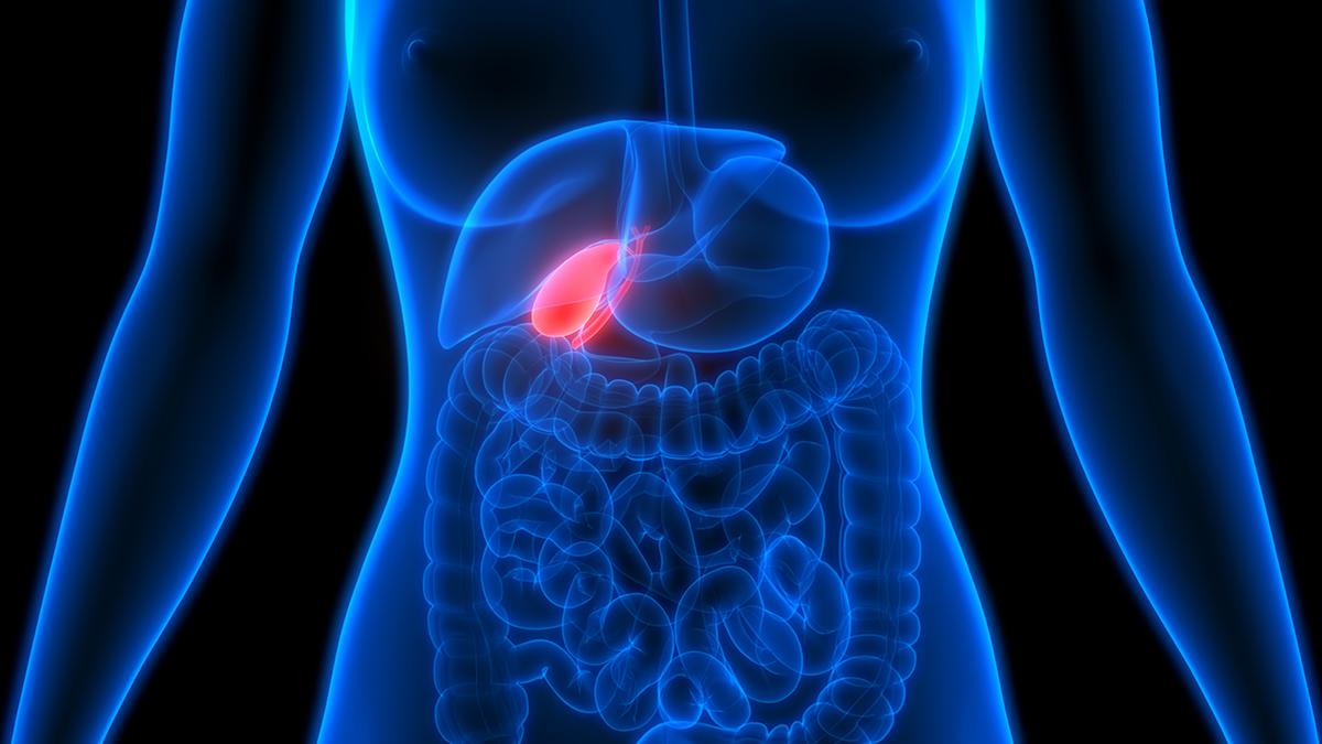 How To Prevent Gallstones During Weight Loss | Woman's World