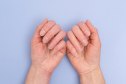 a woman's hands showing her nails, which can indicate underlying health issues