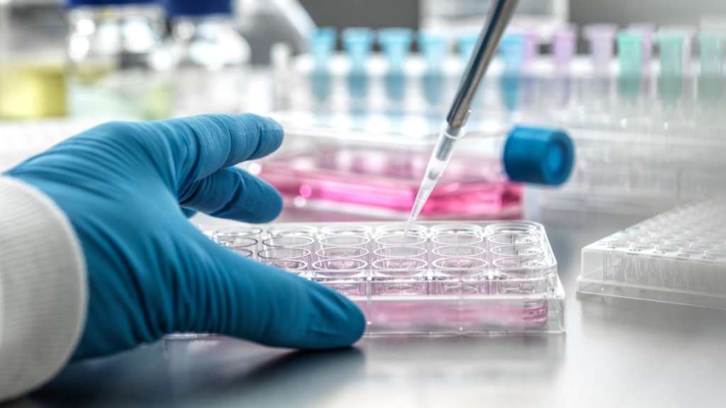 Scientist pipetting medical samples into microplate in laboratory