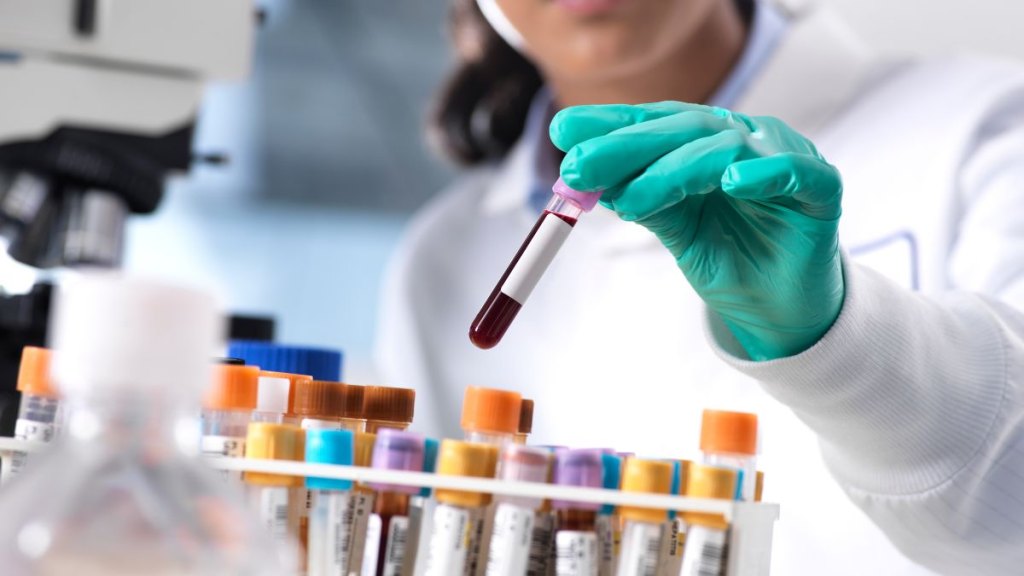 scientist preparing a blood sample