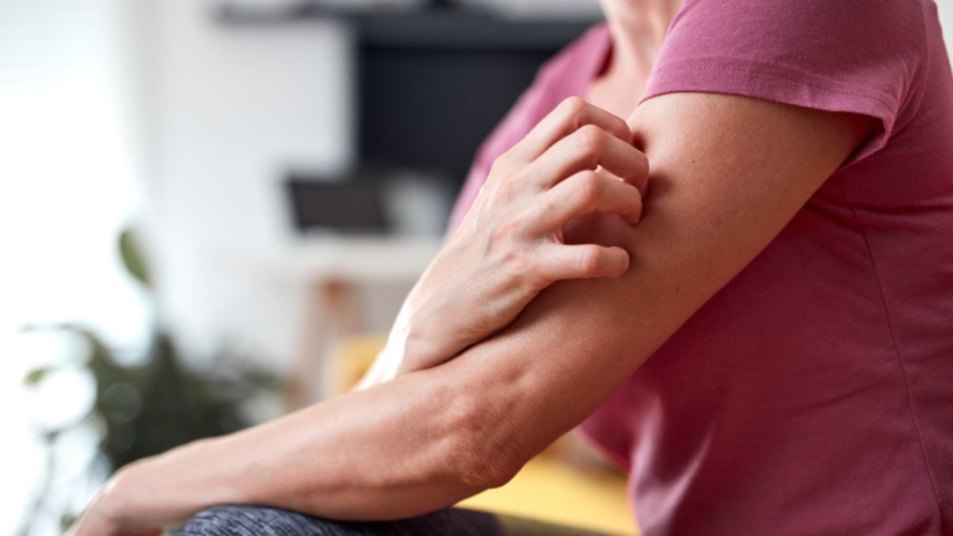 mature woman scratching her arm, which can lead to infected mosquito bite that causes cellulitis