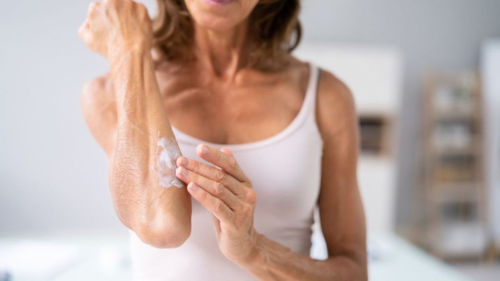 mature woman using moisturizing lotion to get rid of a heat rash quickly